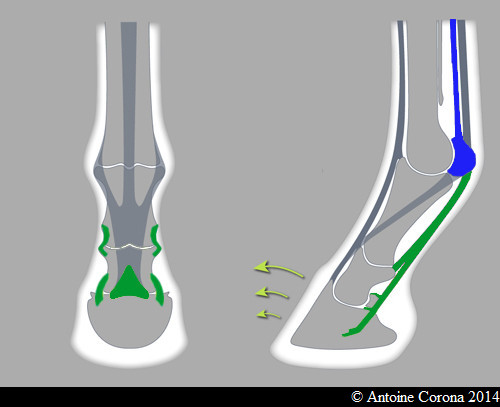 Fer alu sport+ 3 pinçons (Type 340) 