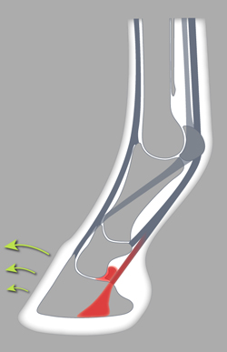 Fer alu oignon 3 pinçons (Type 200)